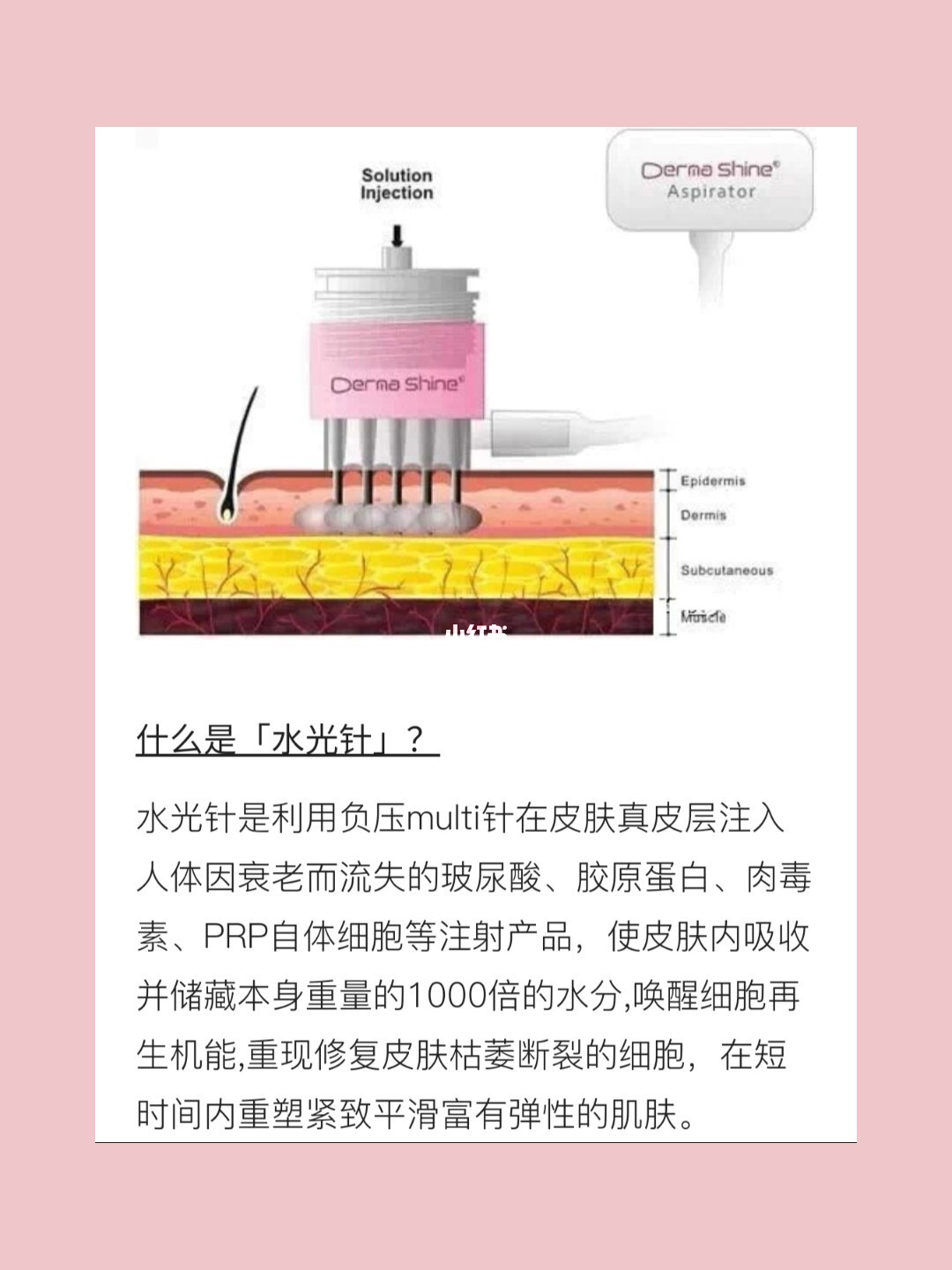 丰胸打针对以后有啥影响吗_打丰胸针效果能维持多久_丰胸可以打针丰胸的吗