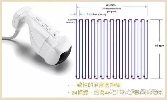 仪器减肥美容图片_仪器减肥美容加盟_减肥美容仪器