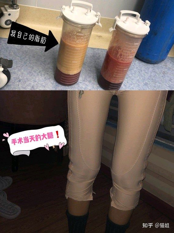 仪器减肥美容加盟_减肥美容仪器_仪器减肥美容图片