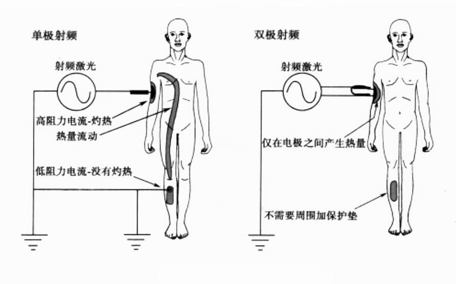 减肥美容仪器_仪器减肥美容仪有用吗_仪器减肥美容加盟