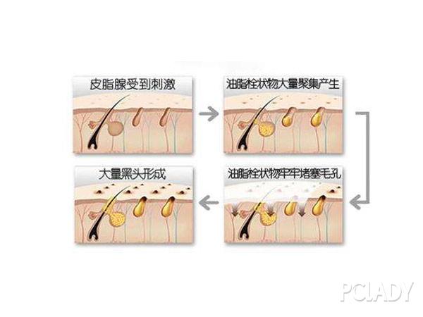 脸上出油补妆是用散粉还是气垫_面部出油如何补妆_脸出油补妆