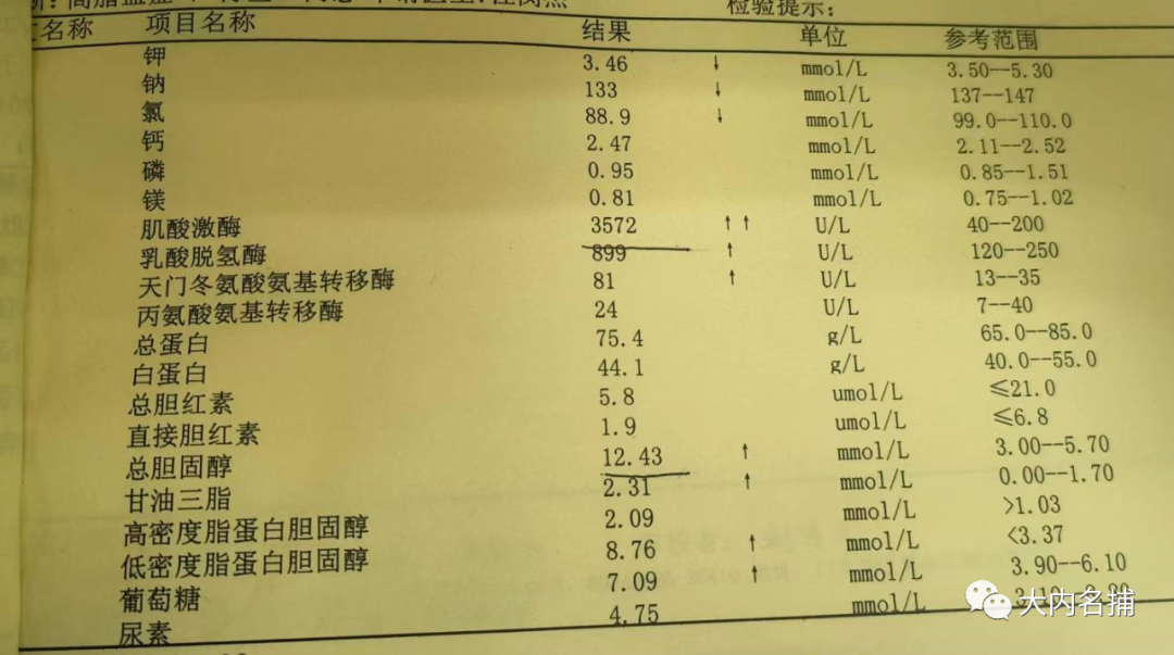 高激酸肌酶血症_引起肌酸激酶高的药物有哪些_肌酸激酶高的危害