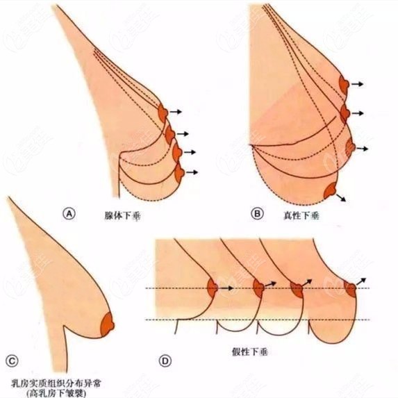 健康减肥不瘦胸_健康减肥不瘦胸_健康减肥不瘦胸
