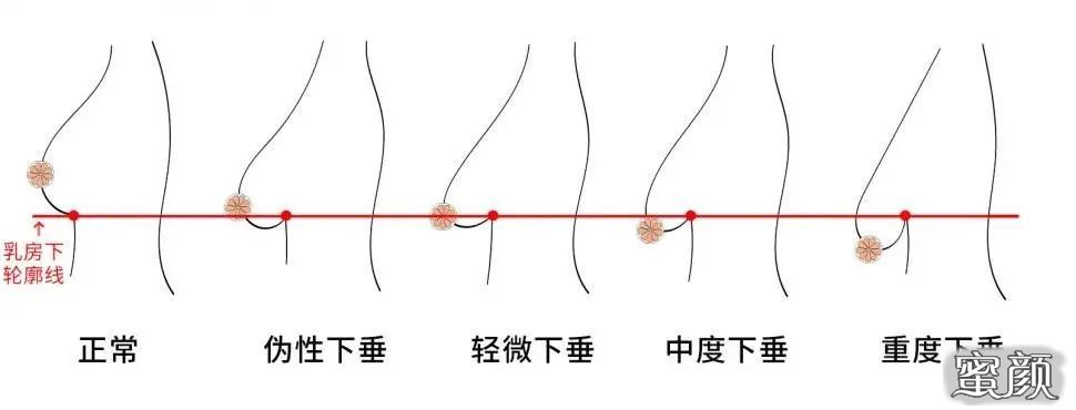健康减肥不瘦胸_健康减肥不瘦胸_健康减肥不瘦胸