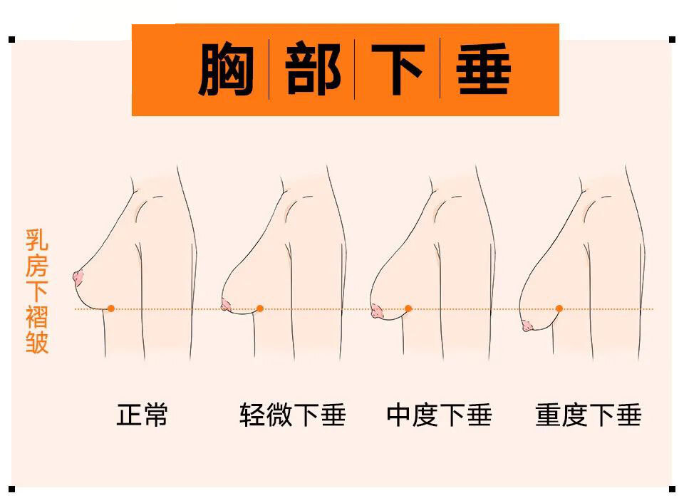 健康减肥不瘦胸_健康减肥不瘦胸_健康减肥不瘦胸