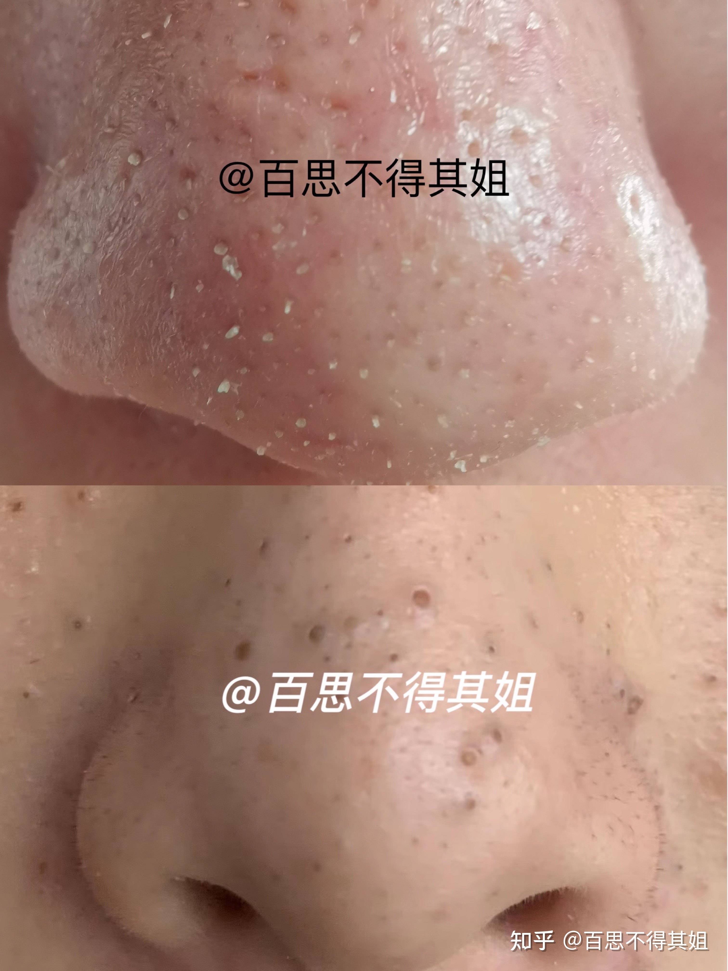 化妆鼻子黑头有什么用_化妆鼻子黑头明显_鼻子有黑头怎么化妆