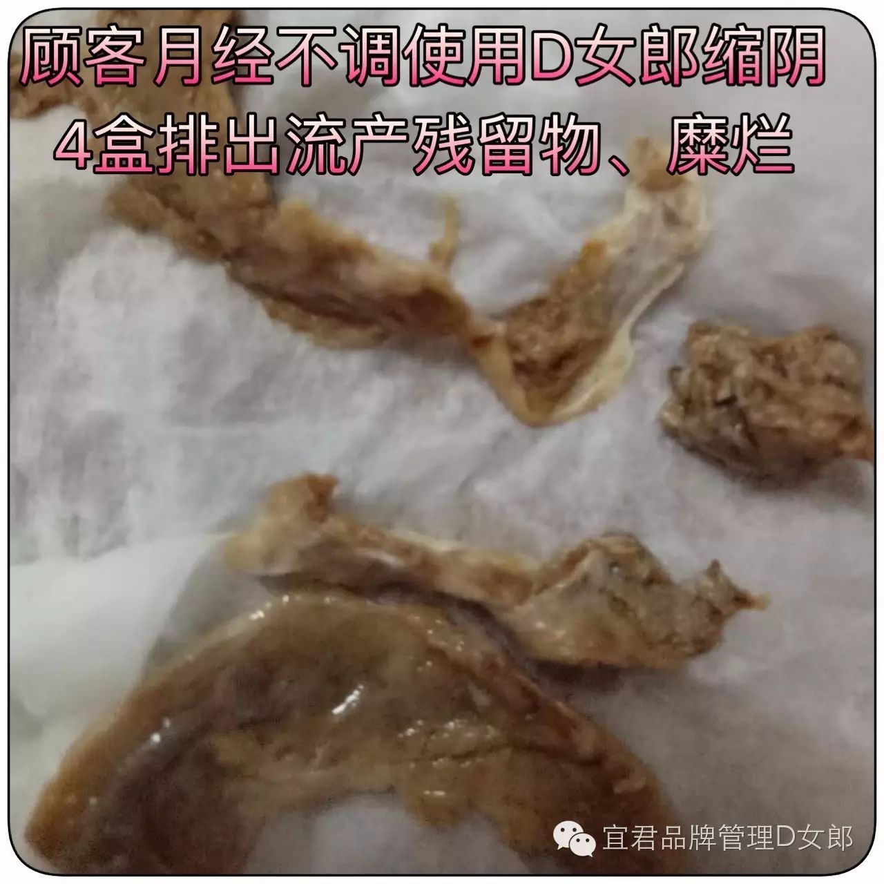 哪种缩阴产品效果好_哪种缩阴产品效果好_哪种缩阴产品效果好