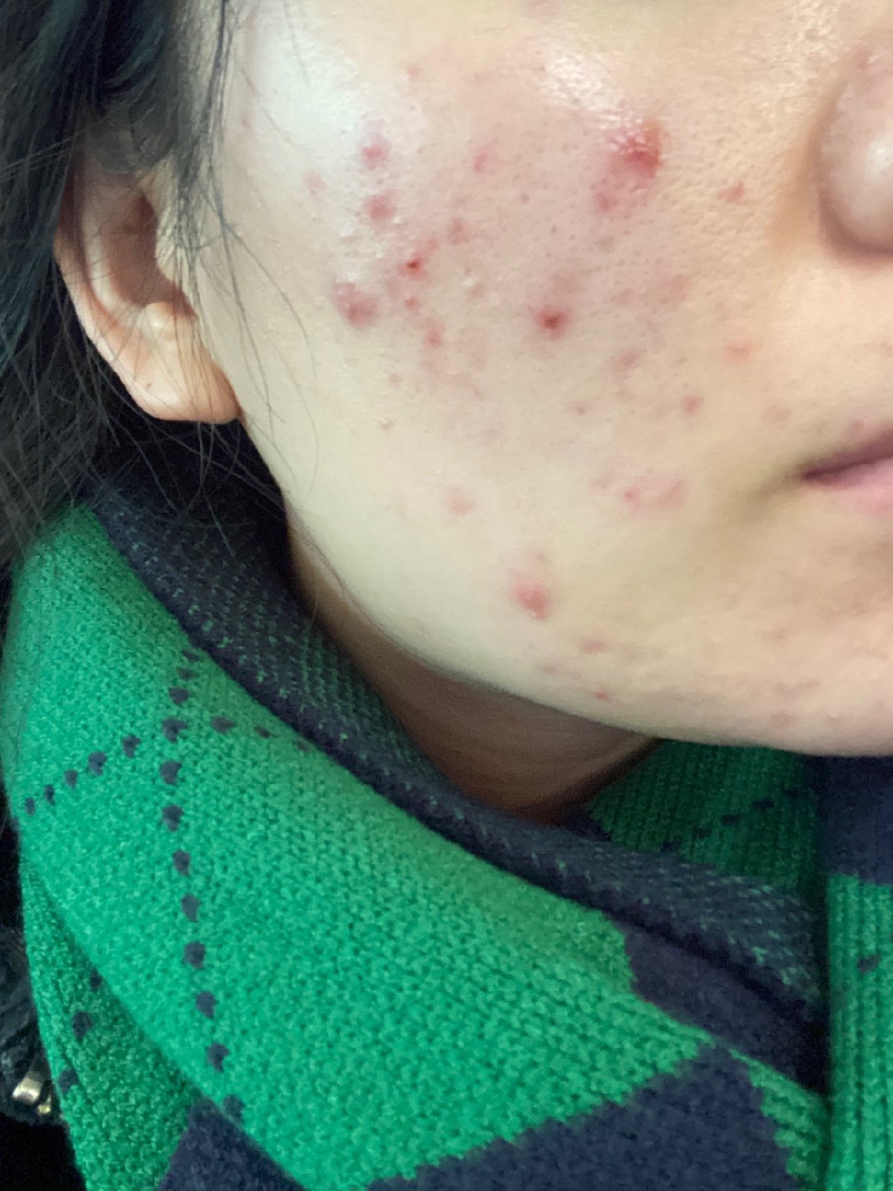 护肤女生说_护肤女生八件套_15岁女生怎么护肤