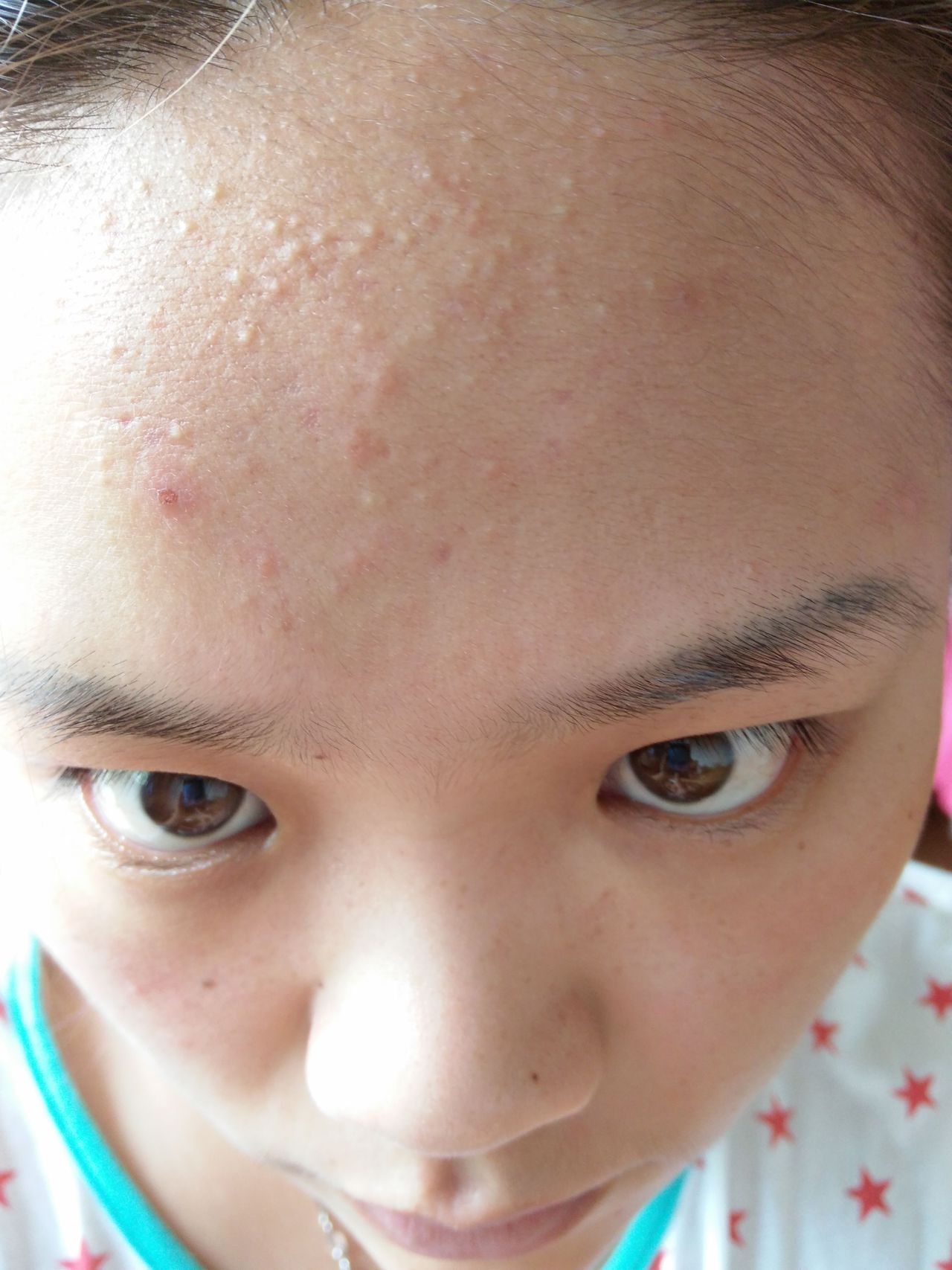 15岁女生怎么护肤_护肤女生八件套_护肤女生说