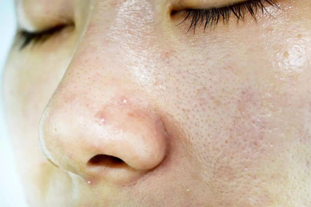 护肤女生八件套_护肤女生说_15岁女生怎么护肤