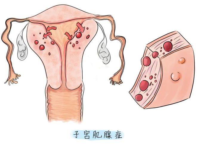 食疗调节内分泌_食疗调节内分泌失调_调理内分泌失调的食谱