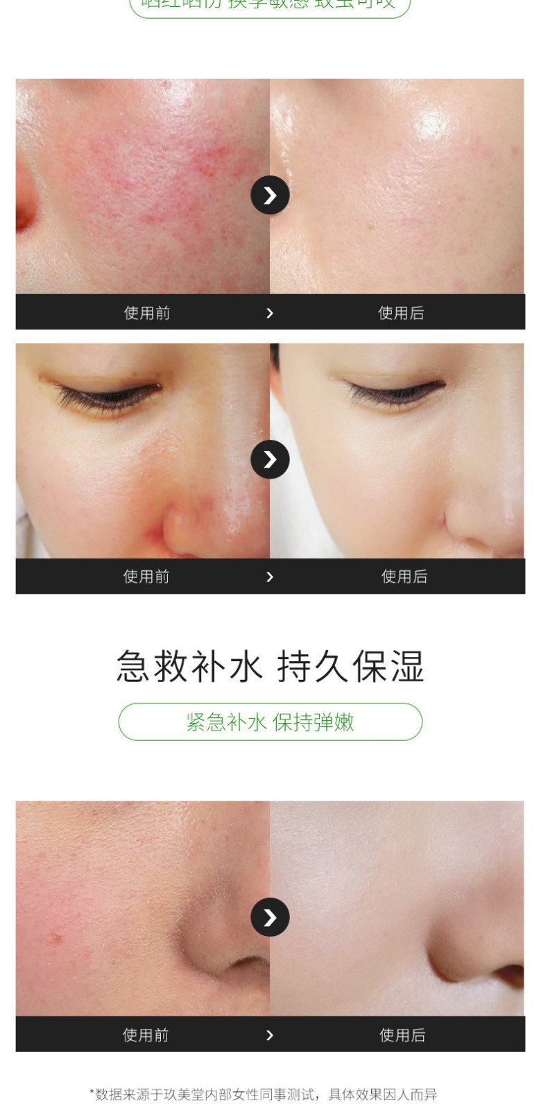 婵真调理霜和调节霜的区别_婵真调理霜的使用方法_婵真调理霜效果怎么样