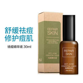调理毛孔的护肤品_雅漾祛油细致毛孔调理露怎么样_毛孔去油