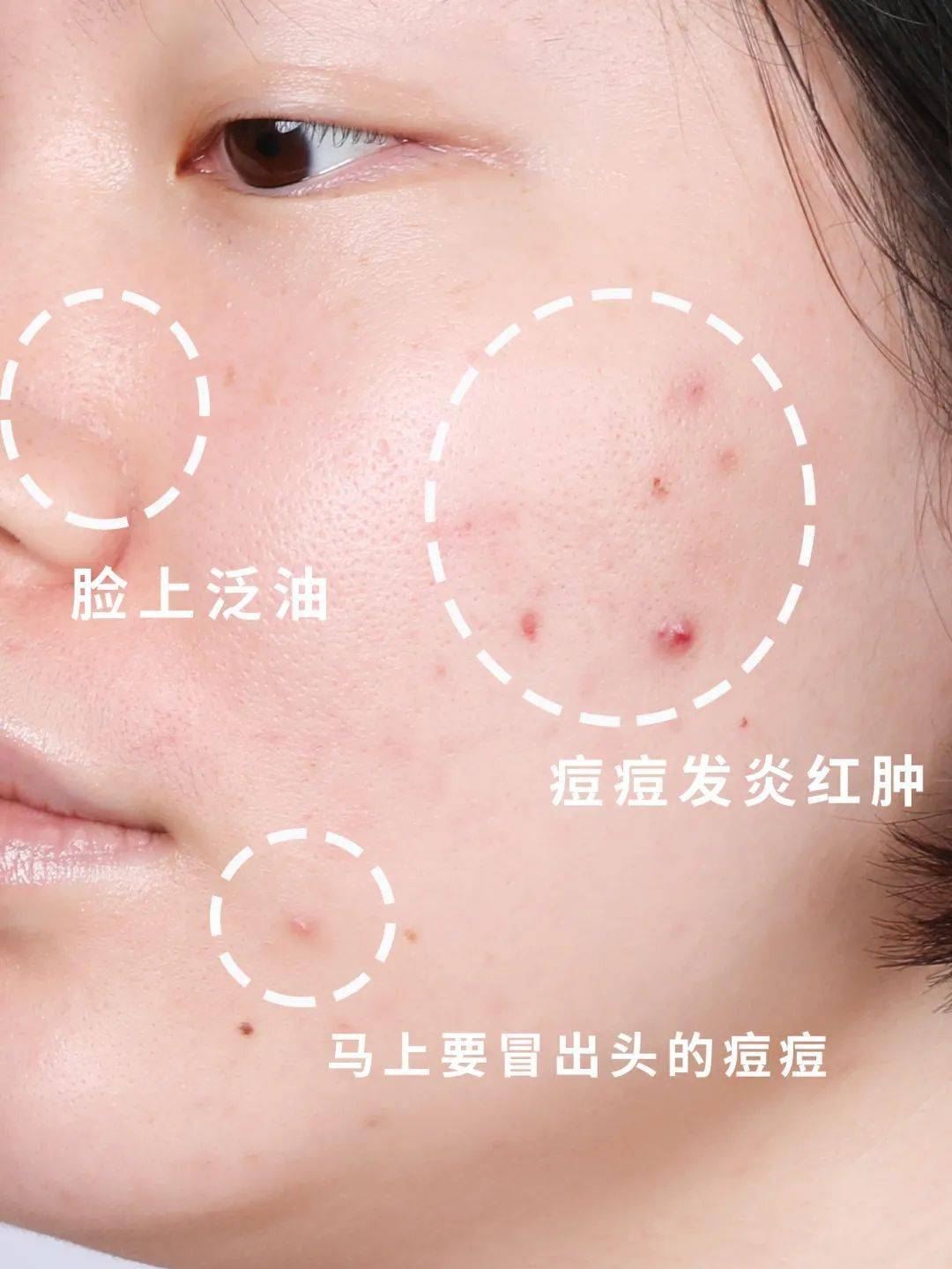 毛孔去油_调理毛孔细致祛样露油怎么用_雅漾祛油细致毛孔调理露怎么样