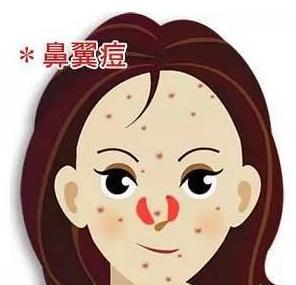 额头右边长痘_右额头长痘痘一碰就变大_右额头长痘痘怎么调理