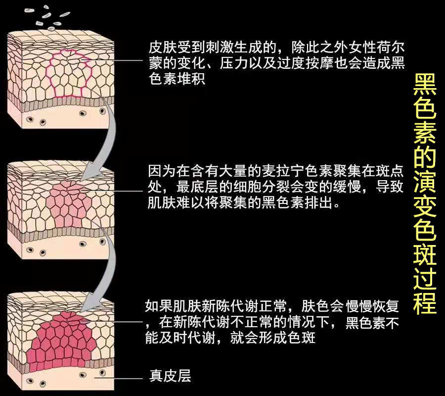 喝中药脸上的斑越明显正常吗_吃中药脸上的斑越来越重了_脸上长黄褐斑中药调理