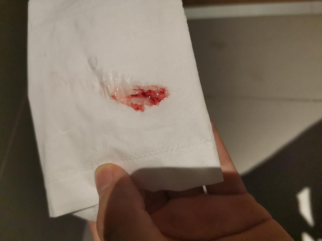出血调理排卵期吃什么药好_出血调理排卵期吃什么药_排卵期出血吃什么调理