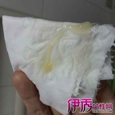 白带黄稠平时怎么调理_白带黄稠平时怎么调理_白带黄稠平时怎么调理