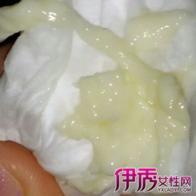 白带黄稠平时怎么调理_白带黄稠平时怎么调理_白带黄稠平时怎么调理