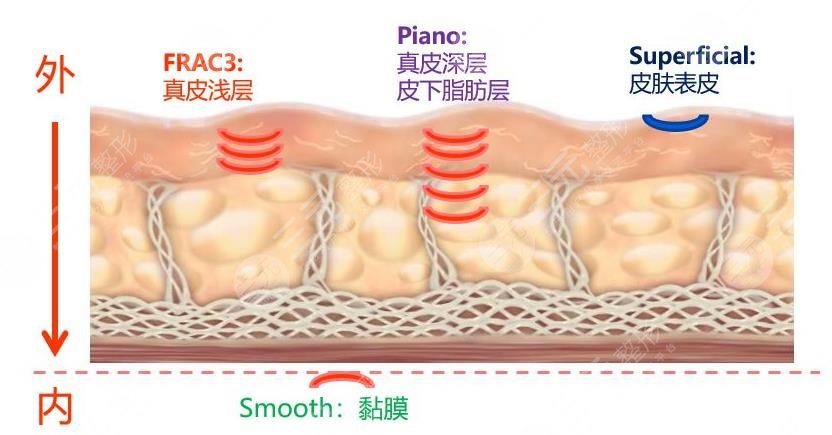 火凤凰溶脂多久一次