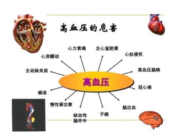 讲脑心脑血管健康问题_血管脑健康心得感悟_心脑血管健康