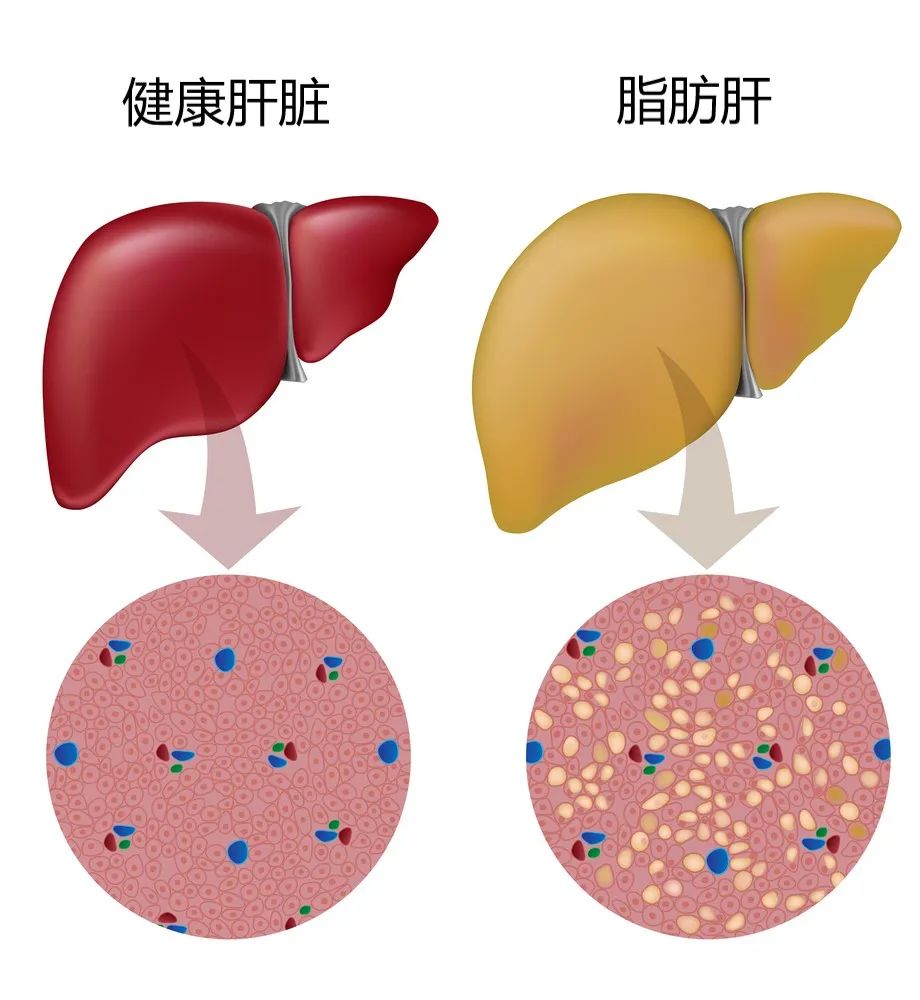 蛋白粉孕妇吃的好处_孕妇蛋白质粉什么时候吃最好_孕妇用碳酸氢钠粉好还是片好