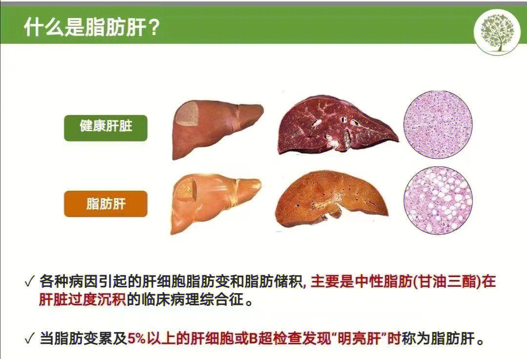 孕妇蛋白质粉什么时候吃最好_孕妇用碳酸氢钠粉好还是片好_蛋白粉孕妇吃的好处