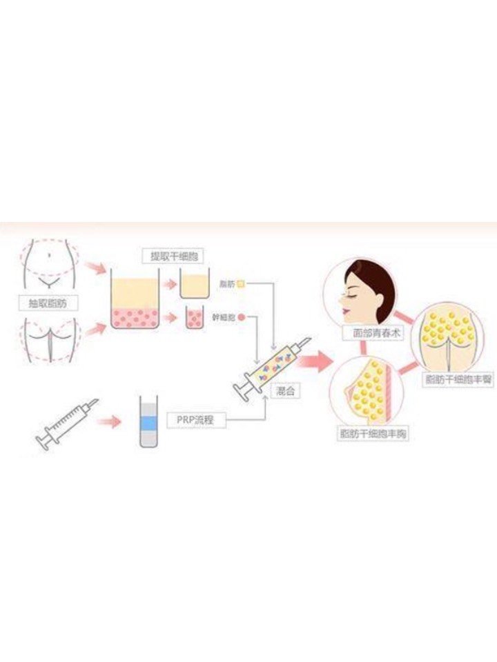 空孕催乳剂药品_自己怎么配空孕催乳剂_如何配制空孕催乳药