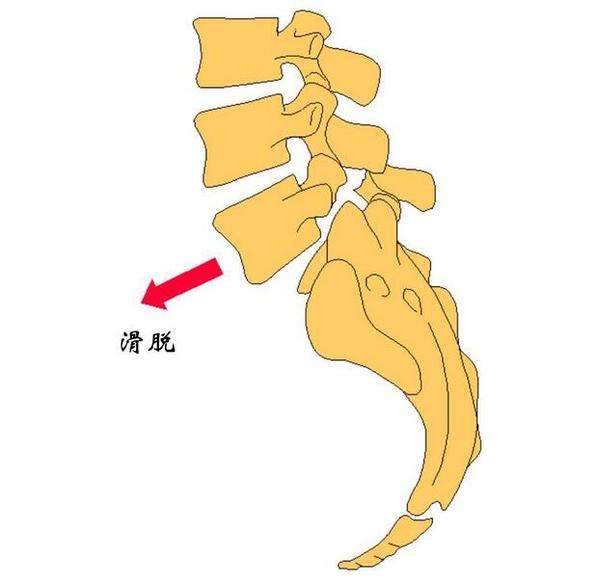 调理中间疼骨脊椎疼_脊椎骨中间疼怎么调理_调理中间疼骨脊椎疼怎么办